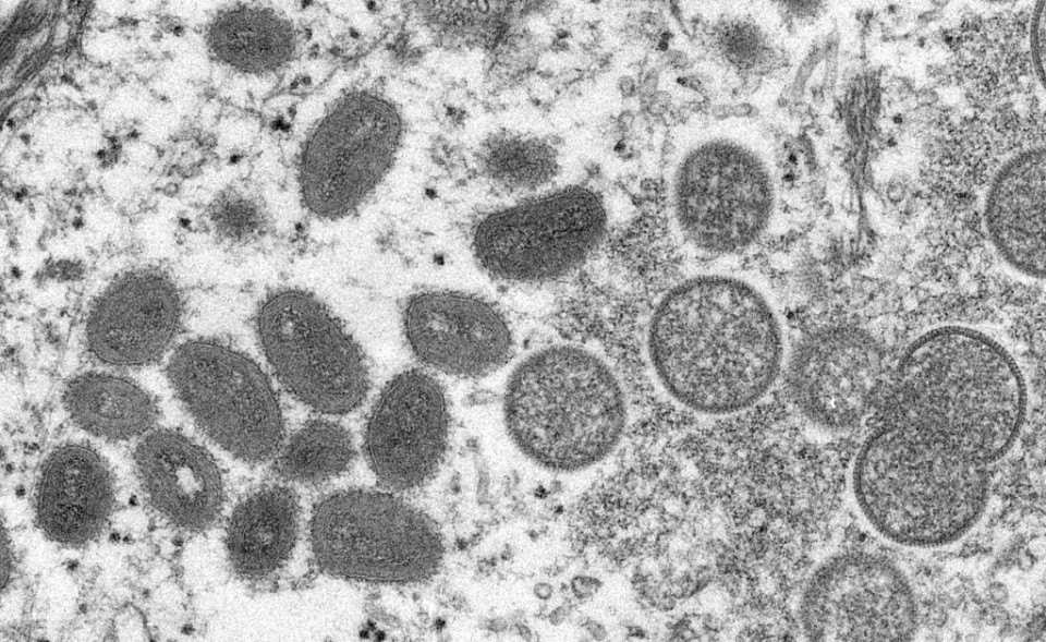 MONKEYPOX-1