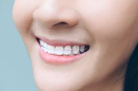 retainer