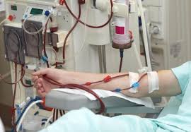 dialysis