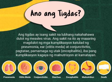 tigdas