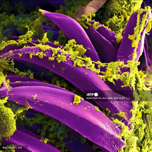 BUBONIC PLAGUE